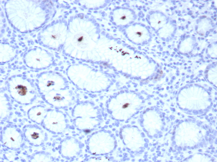 Formalin-fixed, paraffin-embedded human H. pylori-infected stomach stained withHelicobacter Pylori antibody (HPYL/8548R). HIER: Tris/EDTA, pH9.0, 45min. Secondary: HRP-polymer, 30min. DAB, 5min.