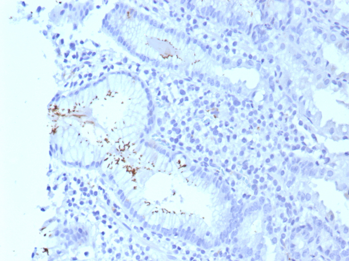 Formalin-fixed, paraffin-embedded human H. pylori-infected stomach stained with Helicobacter Pylori antibody (HPYL/8575R). HIER: Tris/EDTA, pH9.0, 45min. Secondary: HRP-polymer, 30min. DAB, 5min.
