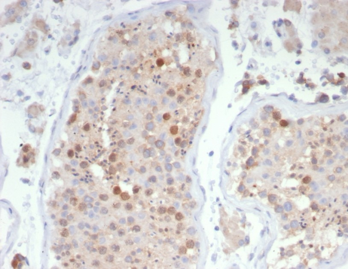 Formalin-fixed, paraffin-embedded human testis stained with KIF2C antibody (KIF2C/4706) at 2ug/ml. HIER: Tris/EDTA, pH9.0, 45min. Secondary: HRP-polymer, 30min. DAB, 5min.