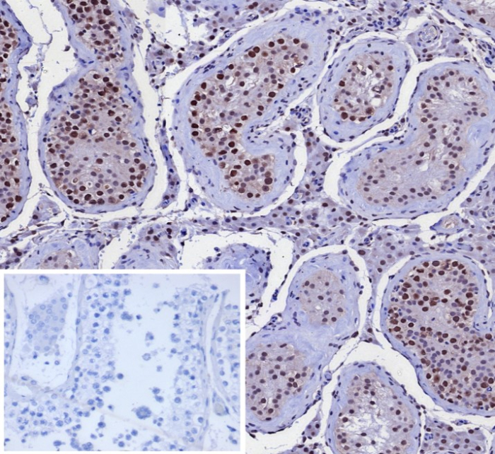Formalin-fixed, paraffin-embedded human testis stained with KIF2C antibody (KIF2C/4707) at 2ug/ml. Inset: PBS instead of primary antibody; secondary only negative control.