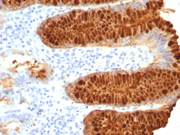 Formalin-fixed, paraffin-embedded human stomach stained with TFF1/pS2 antibody (TFF1/7768). HIER: Tris/EDTA, pH9.0, 45min. Secondary: HRP-polymer, 30min. DAB, 5min.