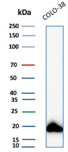 Western Blot Analysis of Colo-38 lysate using Melan-A/MART-1 Antibody (MLANA/8108R).