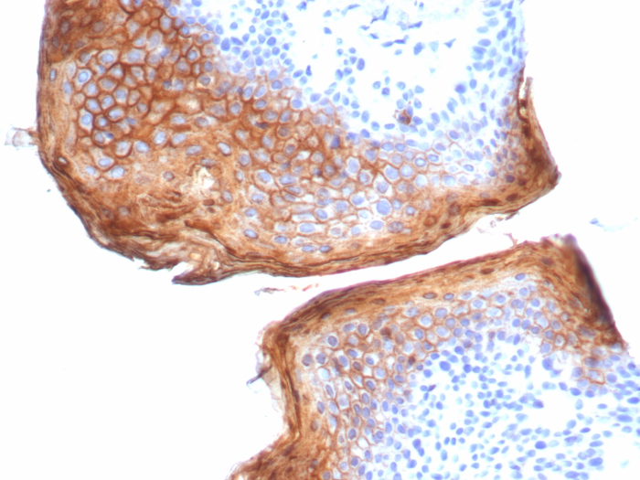 Formalin-fixed, paraffin-embedded human skin stained with SBSN antibody (SBSN/7964). HIER: Tris/EDTA, pH9.0, 45min. Secondary: HRP-polymer, 30min. DAB, 5min.