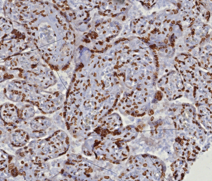 Formalin-fixed, paraffin-embedded human placenta stained with dsDNA antibody (DSD/8204R). HIER: Tris/EDTA, pH9.0, 45min. Secondary: HRP-polymer, 30min. DAB, 5min.