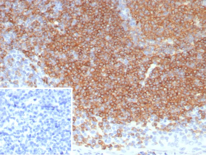 Siglec Cd Antibody Blcam R Nbp Novus Biologicals