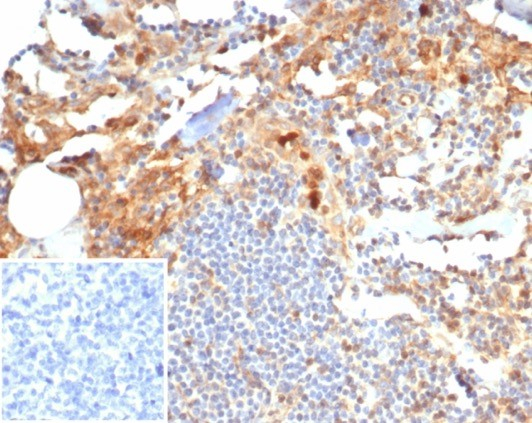 Formalin-fixed, paraffin-embedded human tonsil stained with S100P antibody (S100P/7374). Inset: PBS instead of primary antibody; secondary only negative control.