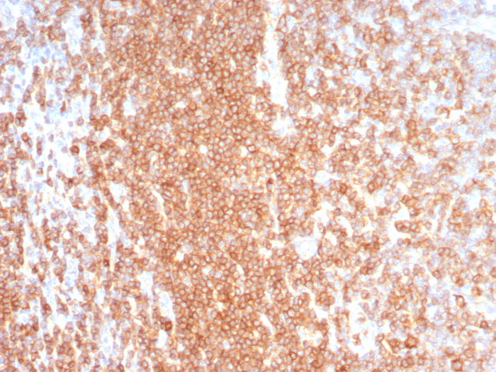 Formalin-fixed, paraffin-embedded human lymph node stained with CD27/TNFRSF7 antibody (LPFS2/8574R). HIER: Tris/EDTA, pH9.0, 45min. Secondary: HRP-polymer, 30min. DAB, 5min.