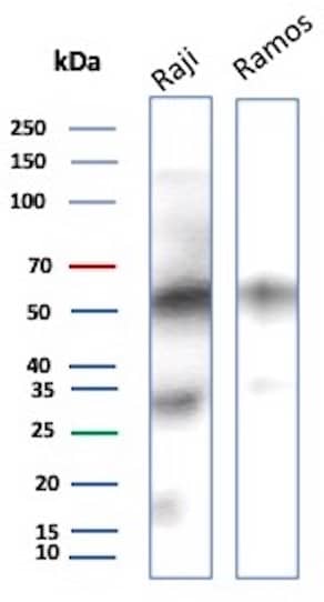 Western Blot Analysis of Raji and Ramos lysate using CD27/TNFRSF7 Antibody (LPFS2/8574R).