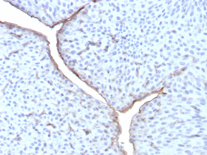 Formalin-fixed, paraffin-embedded human bladder stained with Uroplakin IIIB antibody (UPK3B/8550R). HIER: Tris/EDTA, pH9.0, 45min. Secondary: HRP-polymer, 30min. DAB, 5min.