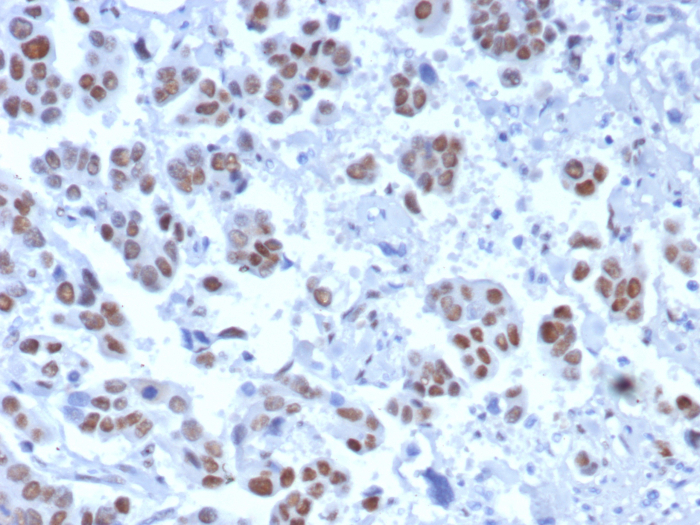 Formalin-fixed, paraffin-embedded human bladder stained with TLE1 antibody (TLE1/8007R). HIER: Tris/EDTA, pH9.0, 45min. Secondary: HRP-polymer, 30min. DAB, 5min.