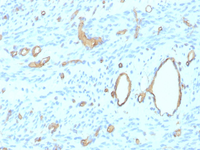 Formalin-fixed, paraffin-embedded human uterus stained with CD34 antibody (rHPCA1/8500). HIER: Tris/EDTA, pH9.0, 45min. Secondary: HRP-polymer, 30min. DAB, 5min.