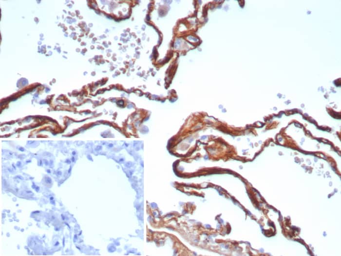 Formalin-fixed, paraffin-embedded human lung stained with Periostin Recombinant Rabbit Monoclonal Antibody (POSTN/8523R). Inset: PBS instead of primary antibody; secondary only negative control.