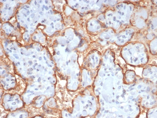 Formalin-fixed, paraffin-embedded human placenta stained with Chorionic Gonadotropin beta Chain (hCG beta) antibody (HCGb/7512R). HIER: Tris/EDTA, pH9.0, 45min. Secondary: HRP-polymer, 30min. DAB, 5min.