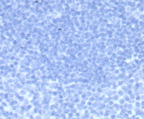 IHC analysis of formalin-fixed, paraffin-embedded human tonsil. Negative tissue control using Chorionic Gonadotropin beta Chain (hCG beta) antibody (HCGb/7512R) at 2ug/ml in PBS for 30min RT. HIER: Tris/EDTA, pH9.0, 45min. Secondary: HRP-polymer, 30min. DAB, 5min.