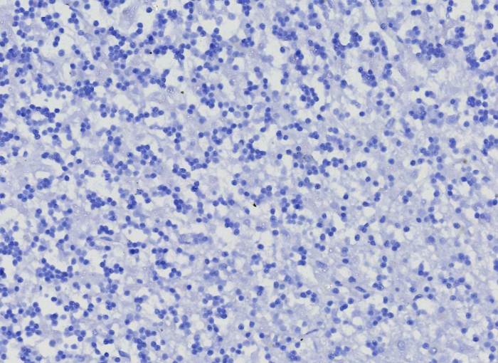 IHC analysis of formalin-fixed, paraffin-embedded human brain. Negative tissue control using Neprilysin/CD10 antibody (MME/8376R) at 2ug/ml in PBS for 30min RT. HIER: Tris/EDTA, pH9.0, 45min. Secondary: HRP-polymer, 30min. DAB, 5min.
