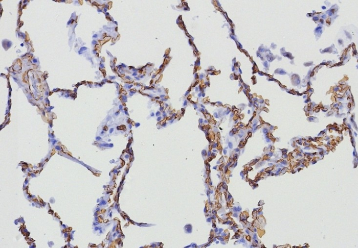 Formalin-fixed, paraffin-embedded human lung stained with CD34 antibody (HPCA1/8333R). HIER: Tris/EDTA, pH9.0, 45min. Secondary: HRP-polymer, 30min. DAB, 5min.