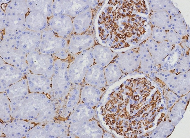 Formalin-fixed, paraffin-embedded human kidney stained with CD34 antibody (HPCA1/8333R). HIER: Tris/EDTA, pH9.0, 45min. Secondary: HRP-polymer, 30min. DAB, 5min.