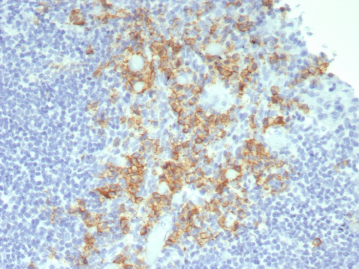 IHC analysis of formalin-fixed, paraffin-embedded human tonsil. Strong cytoplasmic and membranous staining using CD38 antibody (rCD38/8045) at 2ug/ml in PBS for 30min RT. HIER: Tris/EDTA, pH9.0, 45min. Secondary: HRP-polymer, 30min. DAB, 5min.