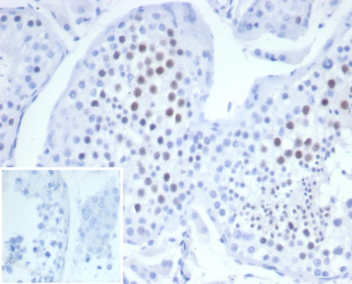 Formalin-fixed, paraffin-embedded human testis stained with KIF2C antibody (KIF2C/6523) at 2ug/ml. Inset: PBS instead of primary antibody; secondary only negative control.