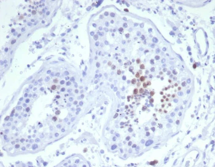 Formalin-fixed, paraffin-embedded human testis stained with KIF2C antibody (KIF2C/6523) at 2ug/ml. HIER: Tris/EDTA, pH9.0, 45min. Secondary: HRP-polymer, 30min. DAB, 5min.