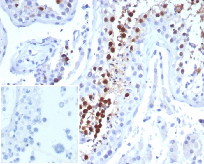 Formalin-fixed, paraffin-embedded human testis stained with KIF2C antibody (KIF2C/6524) at 2ug/ml. Inset: PBS instead of primary antibody; secondary only negative control.