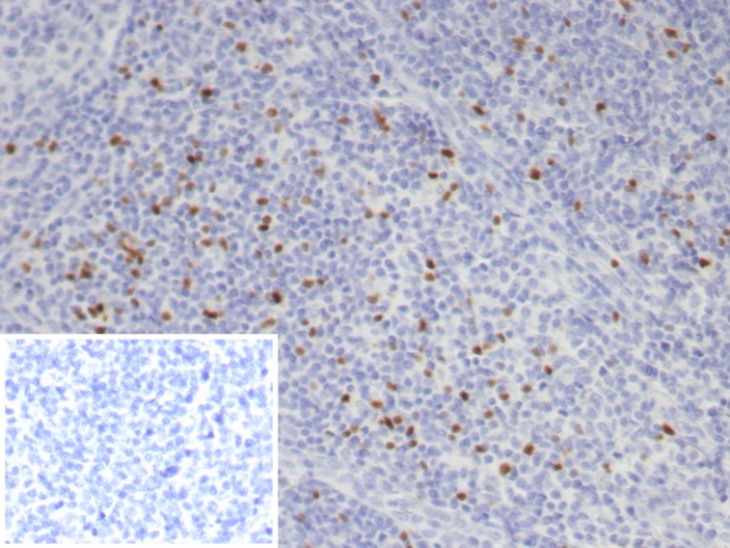 Formalin-fixed, paraffin-embedded human tonsil stained with FoxP3 antibody (FOXP3/7990R). Inset: PBS instead of primary antibody; secondary only negative control.