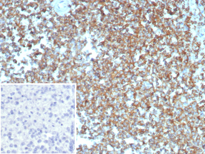 Formalin-fixed, paraffin-embedded human spleen stained with beta-Actin antibody (ACTB/2370). Inset: PBS instead of primary antibody; secondary only negative control.