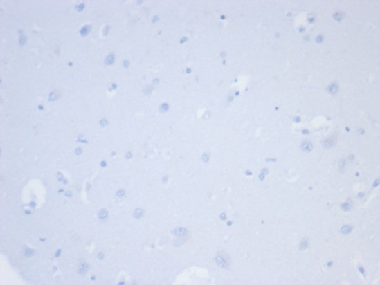 IHC analysis of formalin-fixed, paraffin-embedded human brain. Negative tissue control using Napsin A antibody (NAPSA/7165R) at 2ug/ml in PBS for 30min RT. HIER: Tris/EDTA, pH9.0, 45min. Secondary: HRP-polymer, 30min. DAB, 5min.