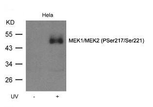 Western Blot: MEK1/2 [p Ser221, p Ser217] Antibody - BSA Free [NBP3-20686] - Western blot analysis of lysed extracts from HeLa cell untreated or treated with UV MEK1/2 (p Ser221, p Ser217) 