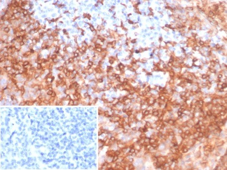 Formalin-fixed, paraffin-embedded human tonsil stained with HLA DRB1 antibody (HLA-DRB/7058R). Inset: PBS instead of primary antibody; secondary only negative control.