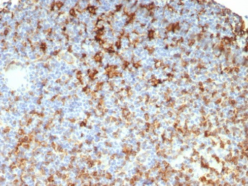 Formalin-fixed, paraffin-embedded human lymph node stained with HLA DRB1 antibody (HLA-DRB/7795R). HIER: Tris/EDTA, pH9.0, 45min. Secondary: HRP-polymer, 30min. DAB, 5min.
