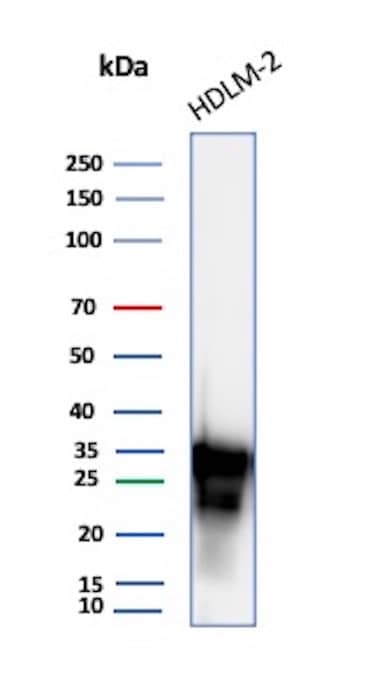 Western blot analysis of HDLM-2 cell line lysate using HLA DRB1 Antibody (HLA-DRB/7795R) - Azide and BSA Free.