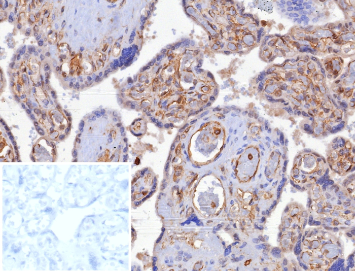 Formalin-fixed, paraffin-embedded human placenta stained with HLA G antibody (HLAG/8344R). Inset: PBS instead of primary antibody; secondary only negative control.