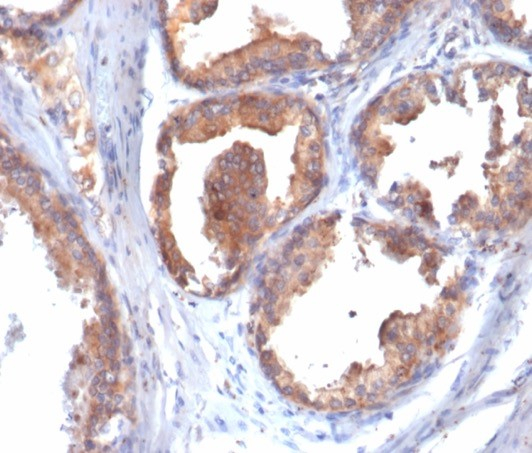 Formalin-fixed, paraffin-embedded human prostate stained with HSP90 beta antibody (HSP90AB1/4970). HIER: Tris/EDTA, pH9.0, 45min. Secondary: HRP-polymer, 30min. DAB, 5min.