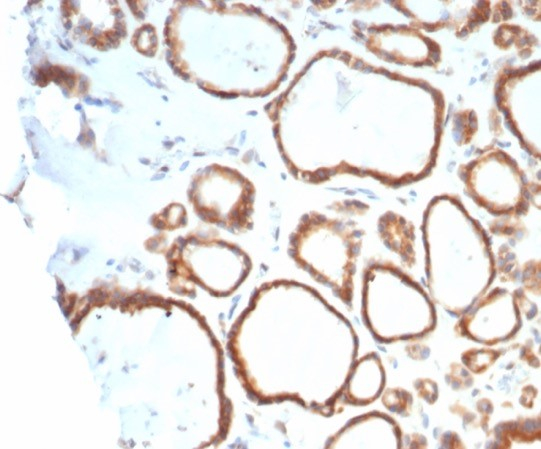 Formalin-fixed, paraffin-embedded human thyroid stained with HSP90 beta antibody (HSP90AB1/4970). HIER: Tris/EDTA, pH9.0, 45min. Secondary: HRP-polymer, 30min. DAB, 5min.