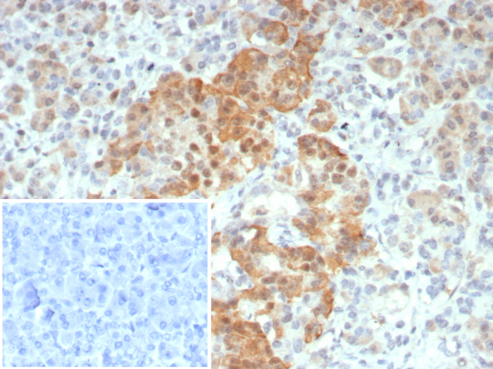 Formalin-fixed, paraffin-embedded human pancreas stained with INSM1 antibody (INSM1/8122R). HIER: Tris/EDTA, pH9.0, 45min. 2: HRP-polymer, 30min. DAB, 5min.