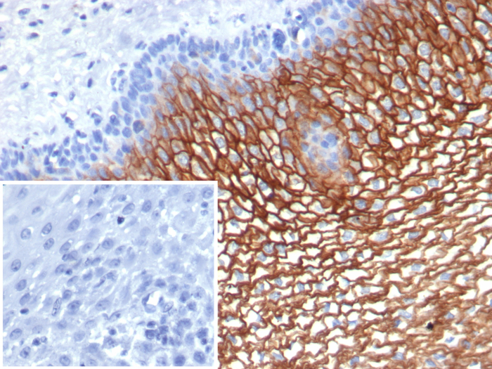 Formalin-fixed, paraffin-embedded human esophagus stained with SBSN antibody (SBSN/7964). Inset: PBS instead of primary antibody; secondary only negative control.