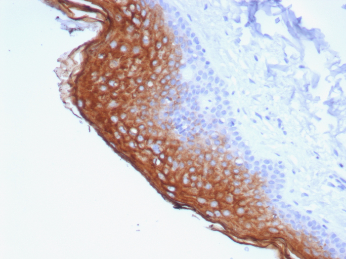 Formalin-fixed, paraffin-embedded human skin stained with SBSN antibody (SBSN/7964). HIER: Tris/EDTA, pH9.0, 45min. Secondary: HRP-polymer, 30min. DAB, 5min.