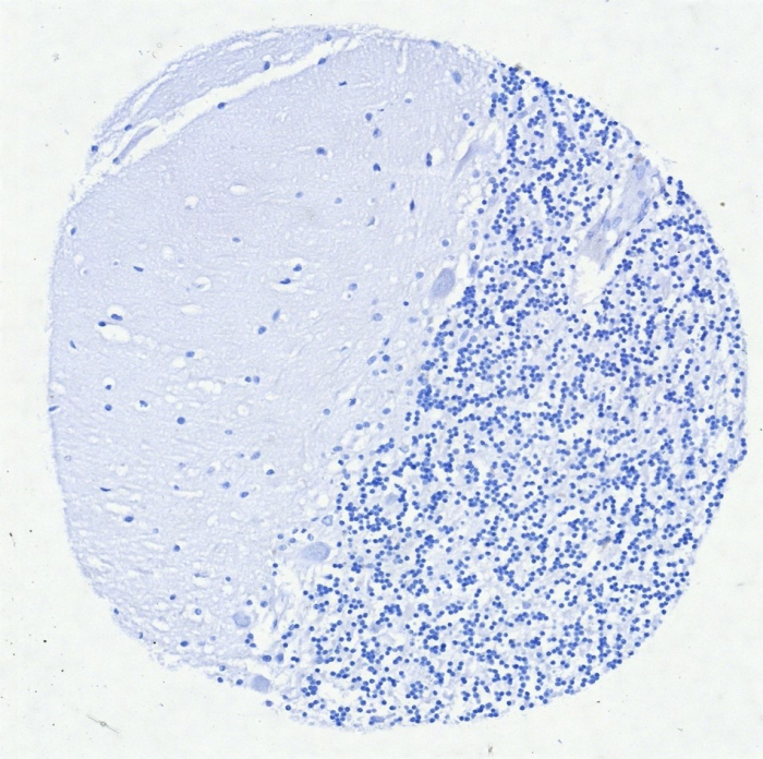 F IHC analysis of formalin-fixed, paraffin-embedded human brain. Negative tissue control using IRF4 antibody (MUM1/8560R) at 2ug/ml in PBS for 30min RT. HIER: Tris/EDTA, pH9.0, 45min. Secondary: HRP-polymer, 30min. DAB, 5min.