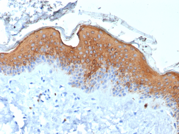 Formalin-fixed, paraffin-embedded human skin stained with Cytokeratin 10 antibody (rKRT10/6923). HIER: Tris/EDTA, pH9.0, 45min. Secondary: HRP-polymer, 30min. DAB, 5min.