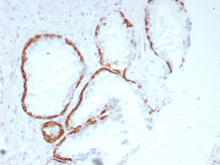 IHC analysis of formalin-fixed, paraffin-embedded human prostate. Negative tissue control using Cytokeratin 14 antibody (rKRT14/8692)). at 2ug/ml in PBS for 30min RT. HIER: Tris/EDTA, pH9.0, 45min. Secondary: HRP-polymer, 30min. DAB, 5min.
