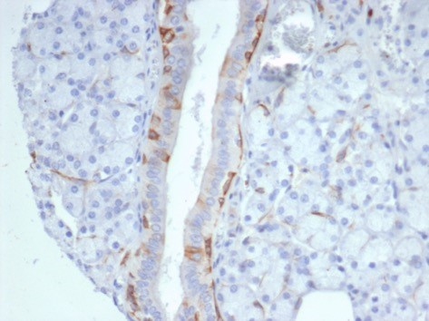 Formalin-fixed, paraffin-embedded human prostate stained with Cytokeratin 14 antibody (KRT14/7047R). HIER: Tris/EDTA, pH9.0, 45min. Secondary: HRP-polymer, 30min. DAB, 5min.