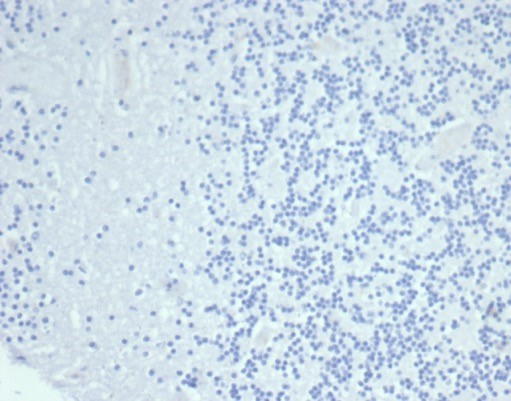 IHC analysis of formalin-fixed, paraffin-embedded human brain. Negative tissue control using Cytokeratin 14 antibody (KRT14/6987R) at 2ug/ml in PBS for 30min RT. HIER: Tris/EDTA, pH9.0, 45min. Secondary: HRP-polymer, 30min. DAB, 5min.