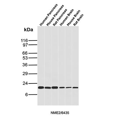 Western blot analysis of Human Pancreas, Mouse Pancreas, Rat Pancreas, Human Brain, Mouse Brain and Rat Brain tissue lysates using NM23-H2/NME2 Antibody (NME2/6435) - Azide and BSA Free.