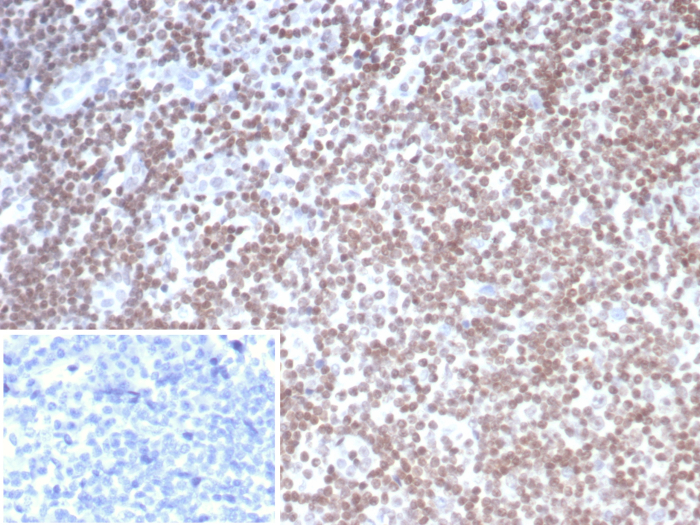 Formalin-fixed, paraffin-embedded human tonsil stained with SmarcAL1 antibody (PCRP-SMARCAL1-1C4). Inset: PBS instead of primary antibody; secondary only negative control.