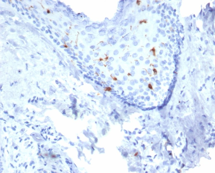 Formalin-fixed, paraffin-embedded human skin stained with Langerin/CD207 antibody (LGRN/7430). HIER: Tris/EDTA, pH9.0, 45min. Secondary: HRP-polymer, 30min. DAB, 5min.