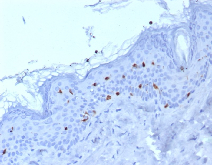 Formalin-fixed, paraffin-embedded human skin stained with Langerin/CD207 antibody (LGRN/7430). HIER: Tris/EDTA, pH9.0, 45min. Secondary: HRP-polymer, 30min. DAB, 5min.