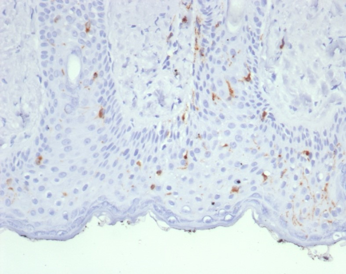 Formalin-fixed, paraffin-embedded human skin stained with Langerin/CD207 antibody (LGRN/7430). HIER: Tris/EDTA, pH9.0, 45min. Secondary: HRP-polymer, 30min. DAB, 5min.