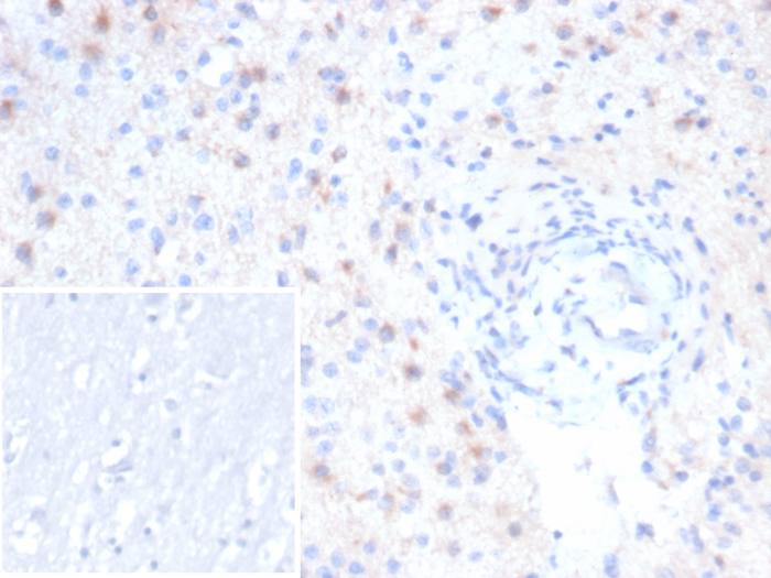 Formalin-fixed, paraffin-embedded human brain stained with EBAG9/RCAS1 antibody (rEBAG9/7264). Inset: PBS instead of primary antibody; secondary only negative control.