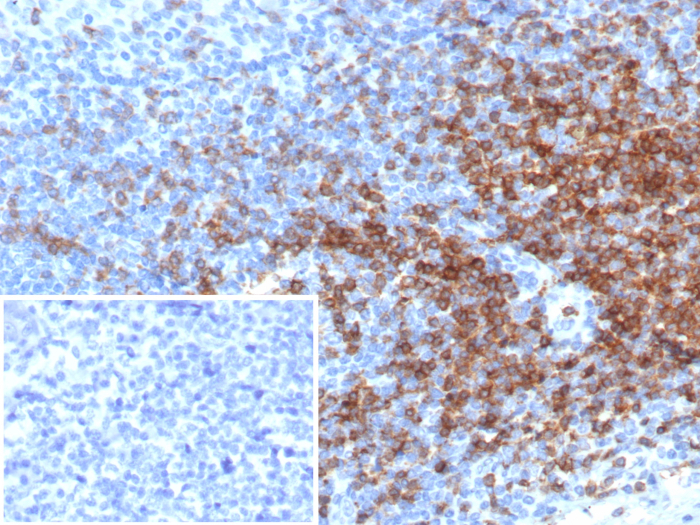 Formalin-fixed, paraffin-embedded human tonsil stained with CD3 epsilon antibody (rC3e/6966). Inset: PBS instead of primary antibody; secondary only negative control.